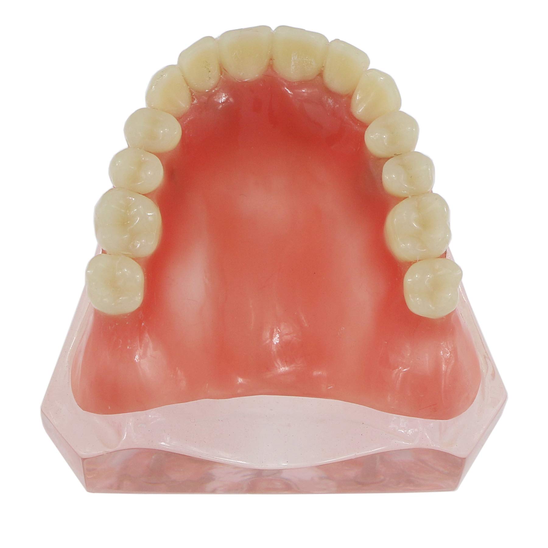 Dental Implant Typodont Model M6001 - Pink Upper Jaw Overdenture with 4 Implants for Superior Restoration | Ideal for Dental Students, Teaching & Clinical Practice