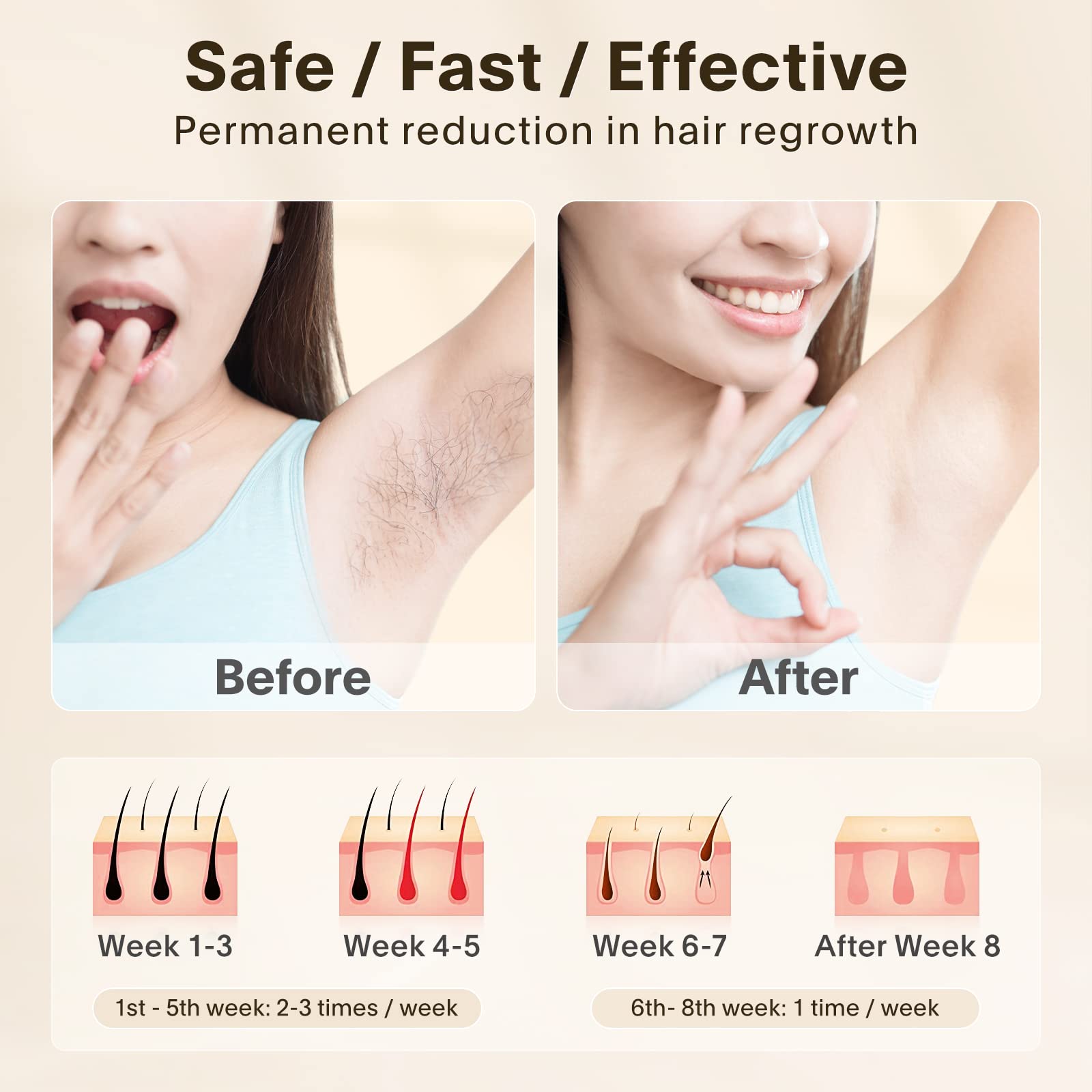 Painless IPL Laser Hair Removal Device for Women & Men - At-Home Permanent Hair Remover for Face & Body | Safe Electrolysis Epilator for Smooth Skin | Perfect for Bikini Line, Legs, Underarms & Facial Hair Removal