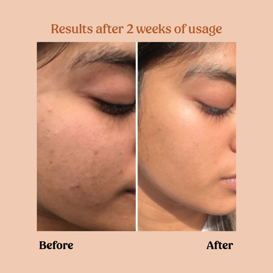 Best Face Brightening Kit for Glowing Skin - Vitamin C Serum & Brightening Cream Set - Perfect for Daily Skincare Routine & Dark Spot Treatment