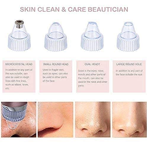 BLOOMIFY 4-in-1 Multi-Function Blackhead & Whitehead Extractor Remover - Acne Pimple Pore Cleaner Vacuum Suction Tool for Men & Women (White) | Perfect for Home Skincare & Facial Treatment