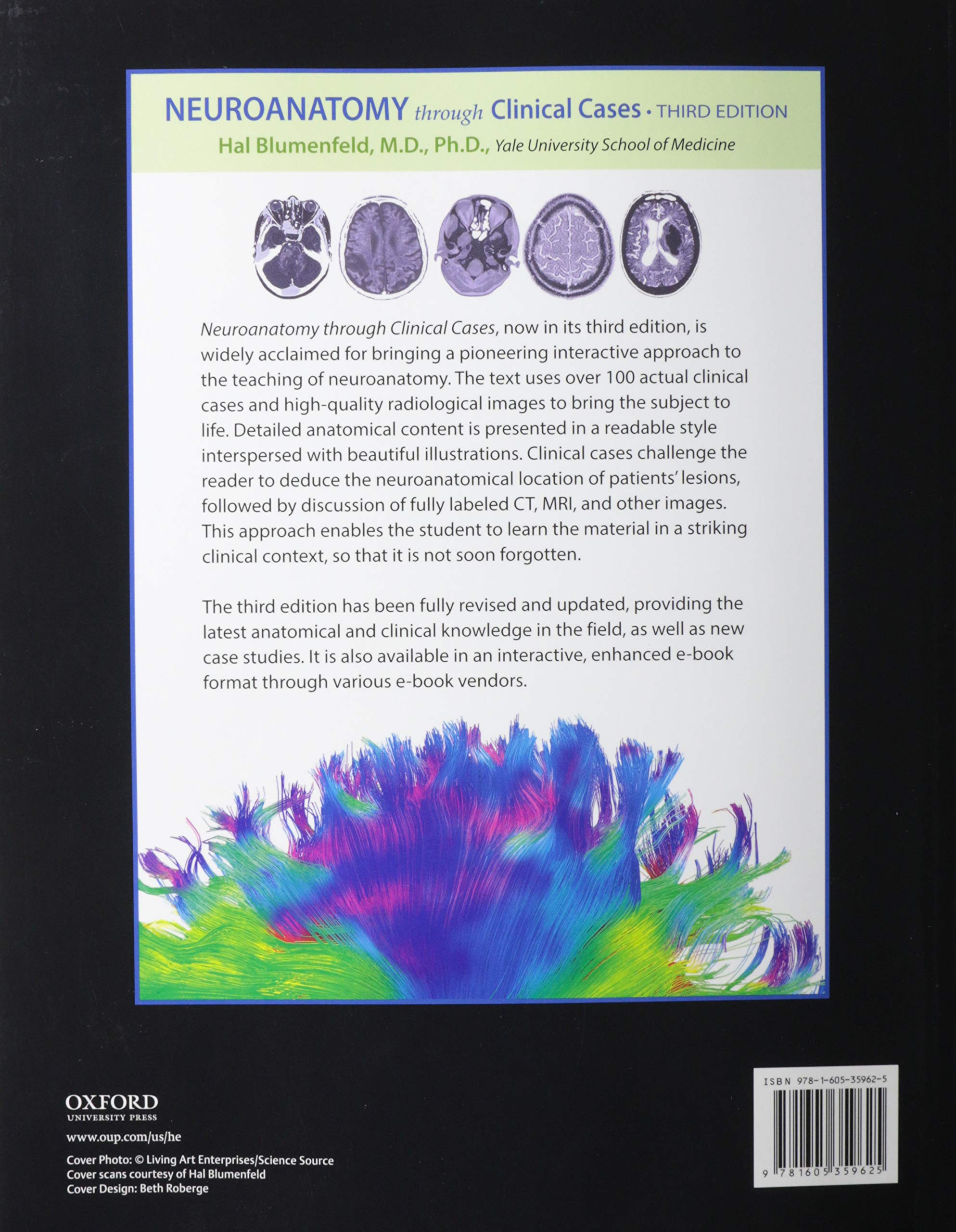 Neuroanatomy through Clinical Cases - Comprehensive Guide for Medical Students & Professionals | Study & Exam Prep