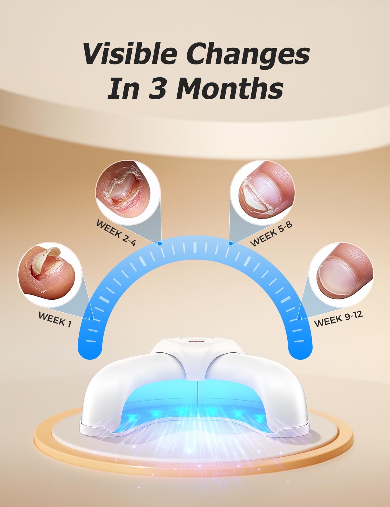 Professional Nail Fungus Light Treatment Device for Toenails & Fingernails - Safe Home Therapy for Onychomycosis, Damaged & Discolored Nails - Ideal for Daily Nail Care & Fungal Infection Prevention
