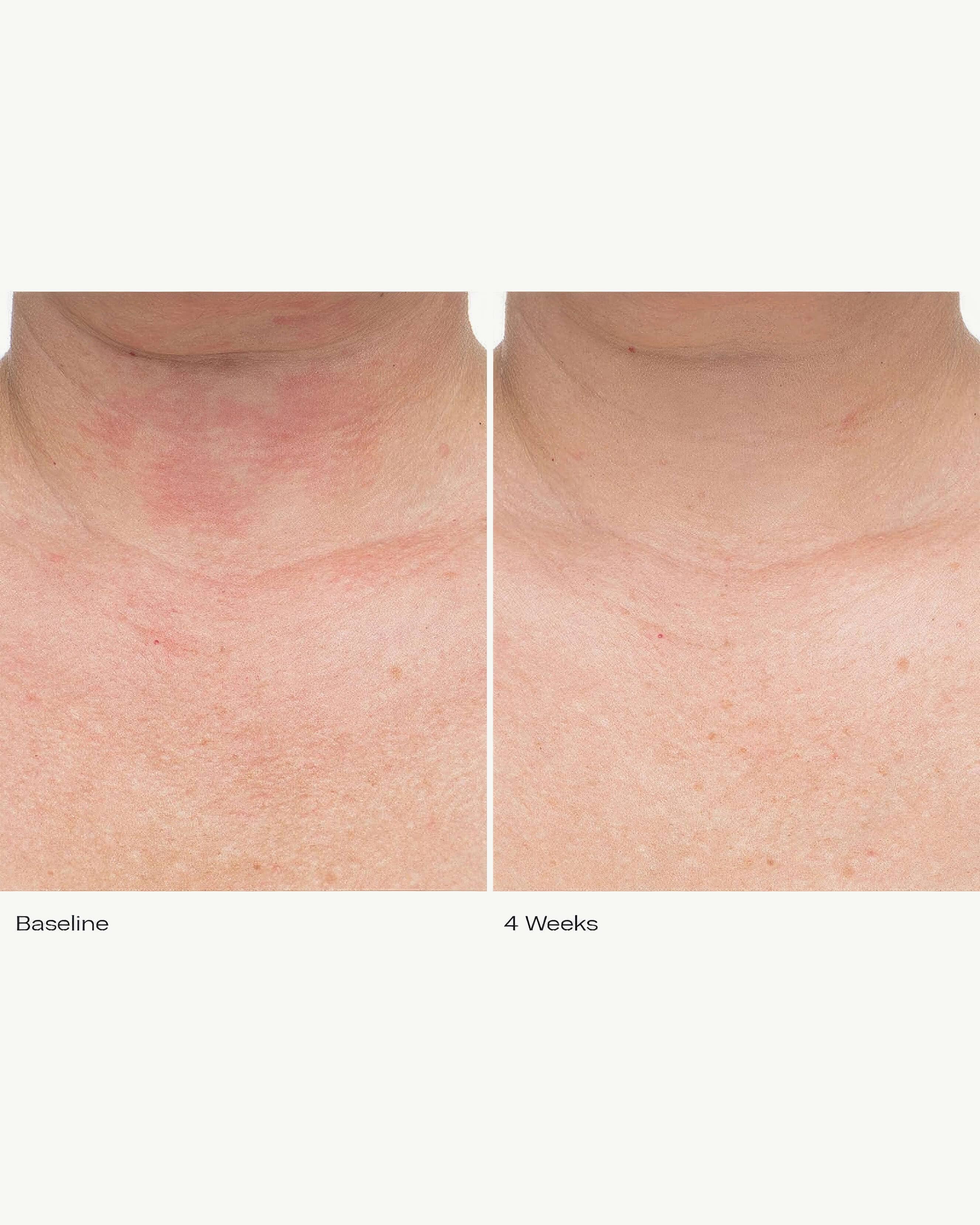 Plumbody™ Hydrating Body Crème - Ultra Moisturizing & Nourishing for Dry Skin | Perfect for Daily Use, After Shower & Nighttime Skincare Routine