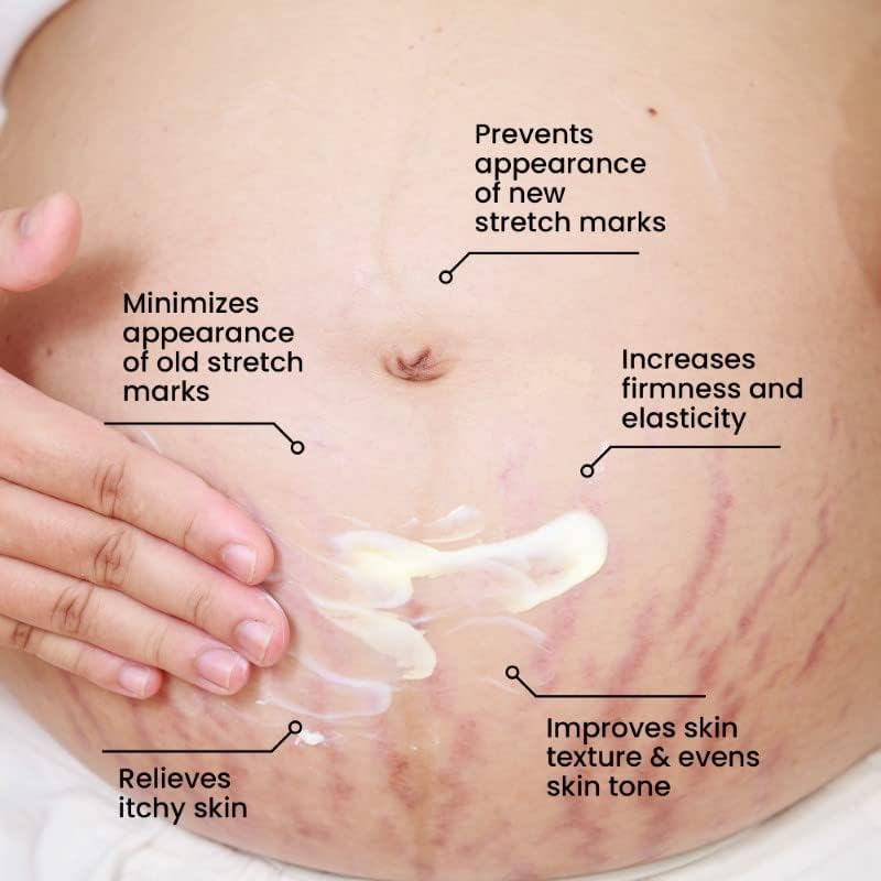 INTIMIFY Stretch Marks Oil & Cream for Women - Pregnancy Safe, 30ml - Hydrating & Nourishing for Belly, Hips & Thighs - Perfect for Pre & Postpartum Care & Daily Skin Moisturizing