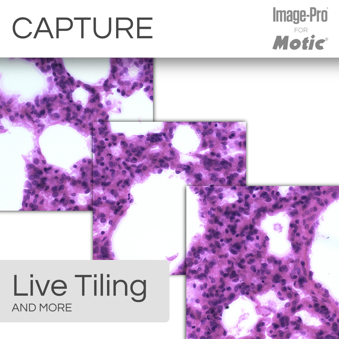 PA53 PATH & Image Pro® Analysis Package - Professional Image Analysis Software for Medical & Research Labs - Perfect for Radiology, Pathology & Scientific Imaging