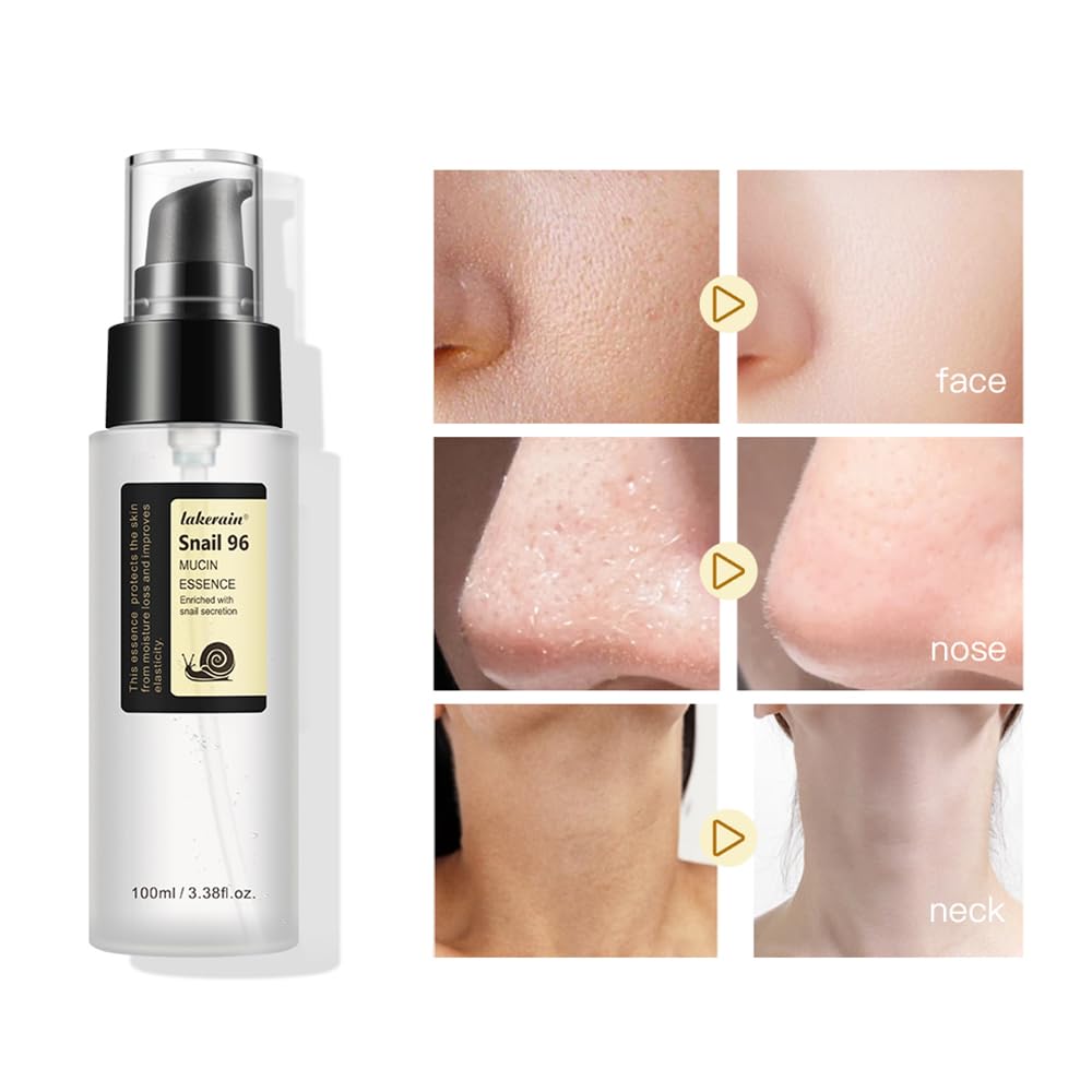 100ML Snail Mucin Serum for Face - Advanced Snail 96 Mucin Power Essence with Hyaluronic Acid | Dark Spot Repair, Hydration & Moisture Boost | Improve Skin Vitality & Elasticity | Perfect for Dry, Sensitive & Aging Skin Care Routine