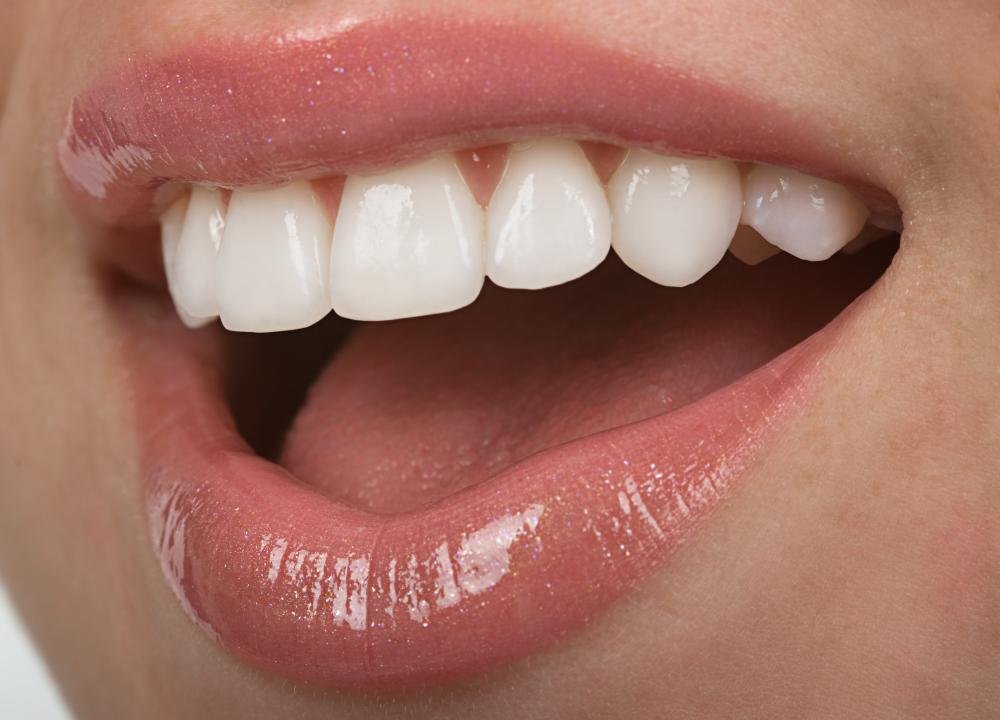 Wallmonkeys WM325100 Teeth Peel and Stick Wall Decals - 36