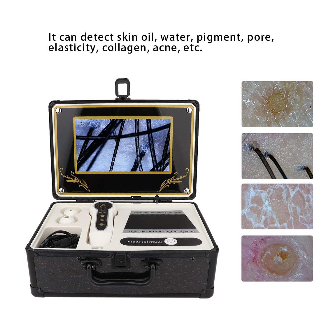 9 Inch LCD Skin & Hair Analyzer Detector - High Magnification Blackhead & Scalp Follicle Scanner for Professional Skin Care & Hair Treatment | Perfect for Dermatologists, Estheticians & Home Use