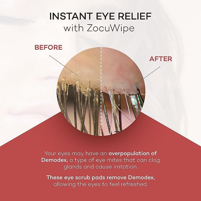 Zocuwipe Eyelid Cleansing Wipes with Okra Complex - Hypoallergenic Eyelid Cleanser & Moisturizer Pads (40 Count) + Zocular ZocuZap Facial Cleansing Wipes (30 Count) Bundle - Perfect for Sensitive Eyes, Makeup Removal & Daily Skincare Routine