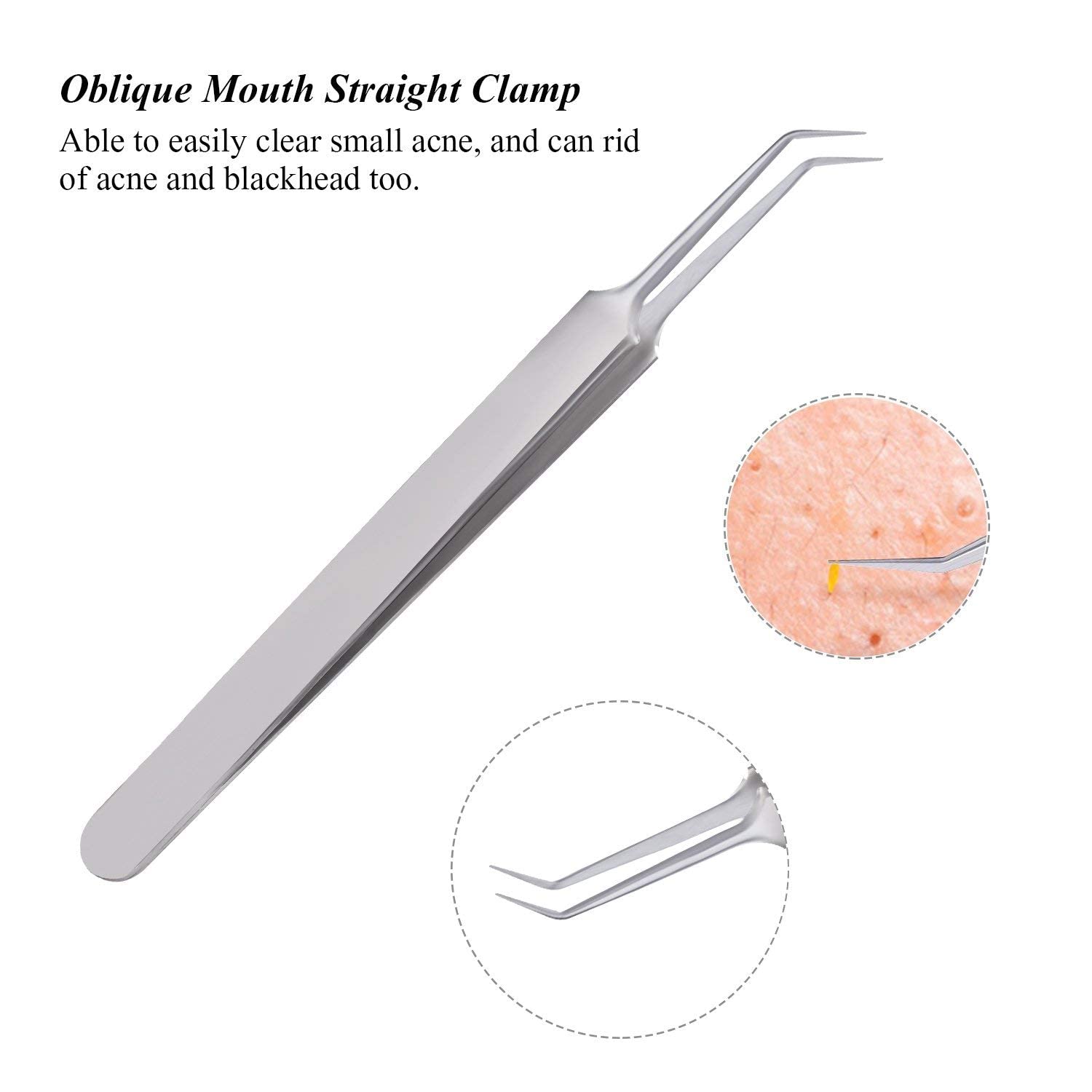 Professional Blackhead & Whitehead Remover Kit - 3 Pcs Stainless Steel Comedone Extractor Tools for Acne & Pimple Popping - Perfect for Facial Skin Care & Blemish Removal at Home