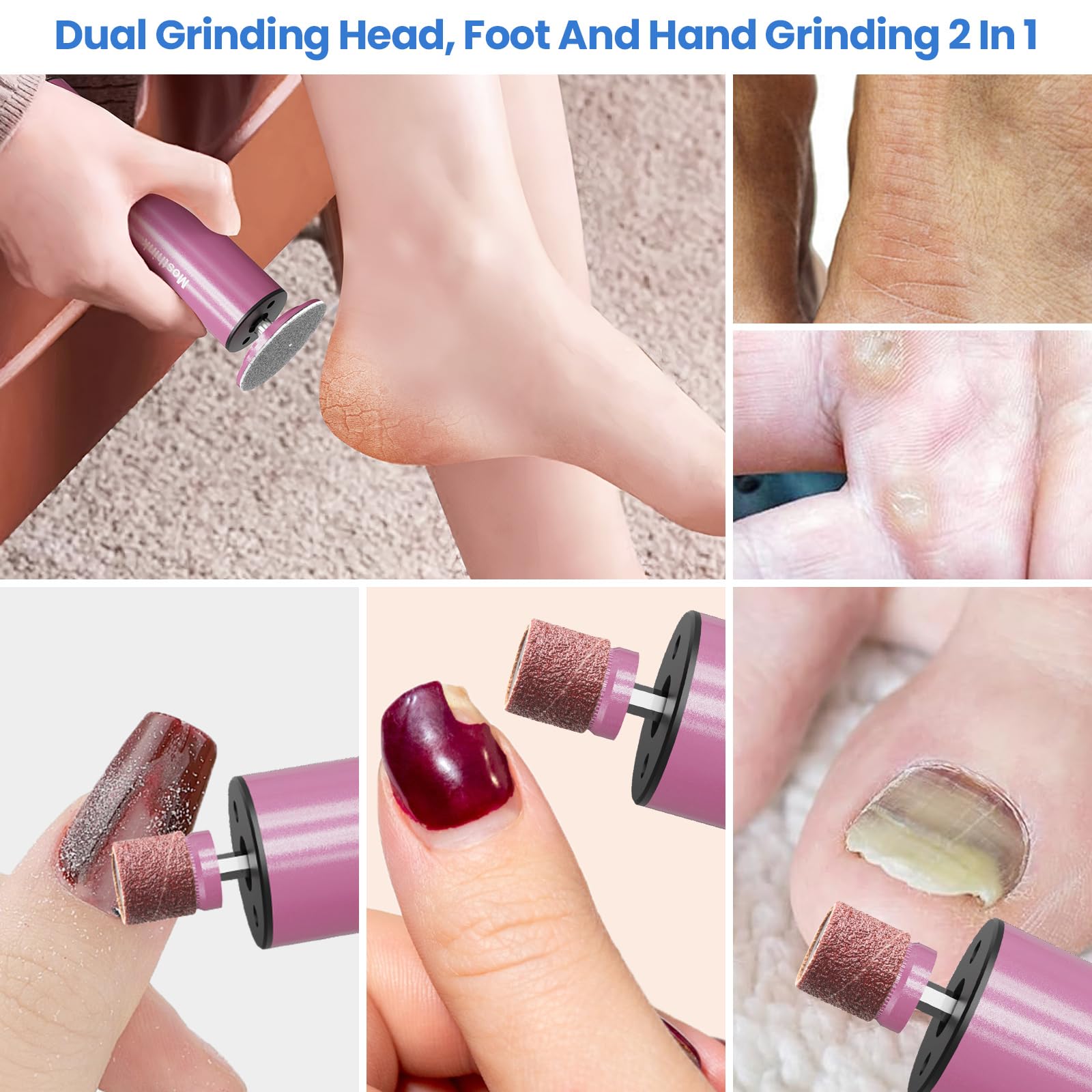 Electric Callus Remover & Foot File - Rechargeable 2-in-1 Pedicure Tool with 6 Adjustable Speeds & Sandpaper Disks for Dead Skin Removal - Perfect for Home Pedicures & Foot Care Routines