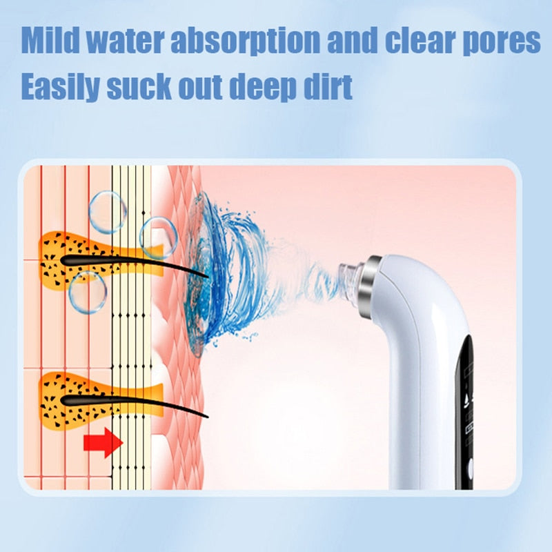 Professional USB-Powered Blackhead Remover Vacuum - Portable Pore Cleaner for Face & Nose - Perfect for Home Spa & Skincare Routine