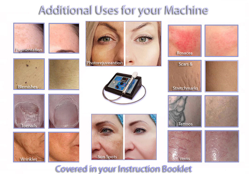 Professional IPL850 LS Intense Pulsed Light System with Large Spot E-Light Flux for Hair Removal & Skin Rejuvenation - Salon & Home Use