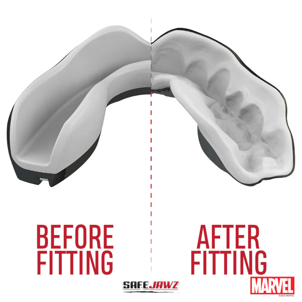 SafeJawz Marvel Venom Mouthguard - Custom Fit Teeth Protection for Sports & Night Grinding - Perfect for Boxing, MMA, Football & Teeth Grinding Relief