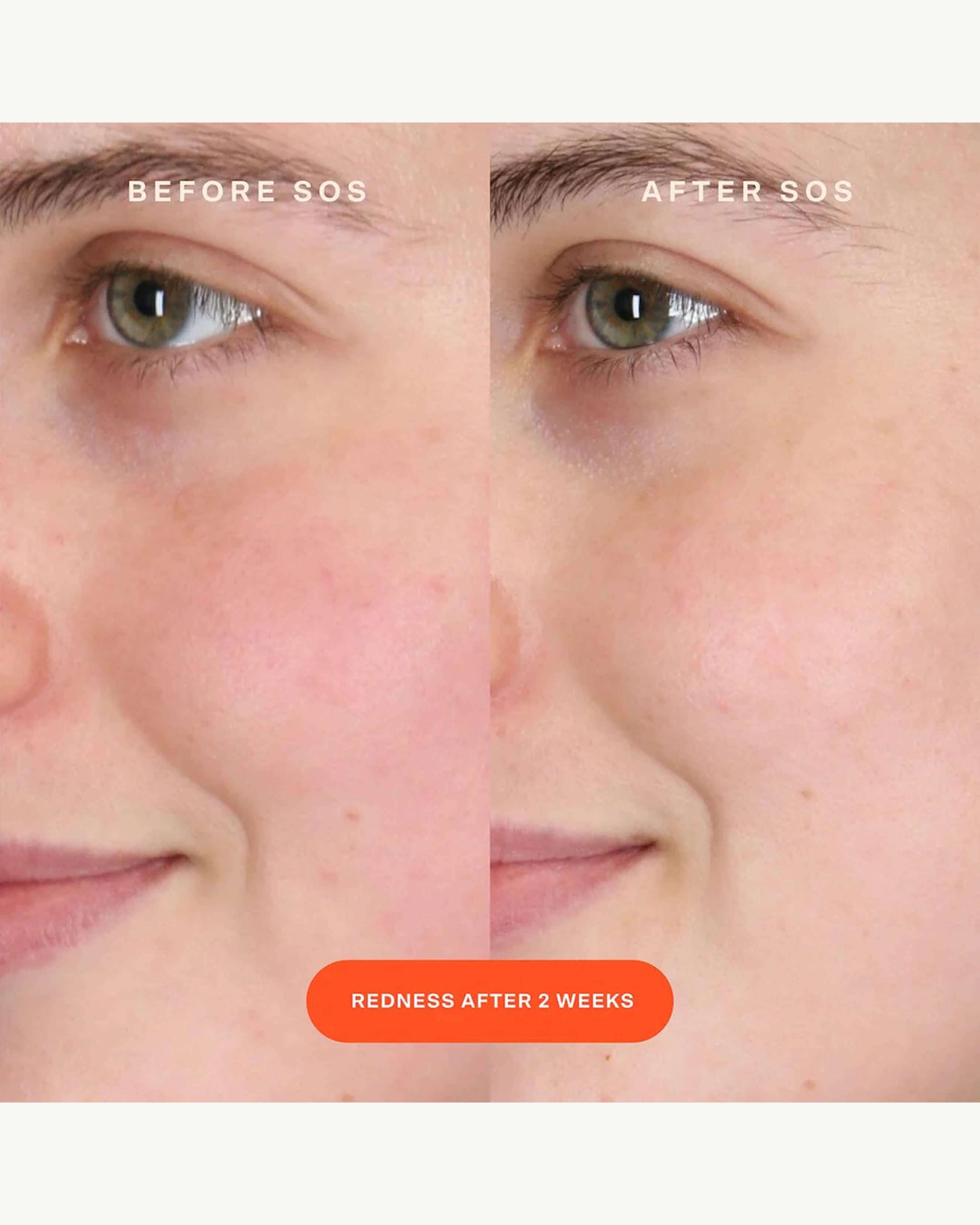 SOS Intensive Rescue Serum - Hydrating & Anti-Aging Face Serum for Dry Skin - Perfect for Night Routine & Travel Skincare