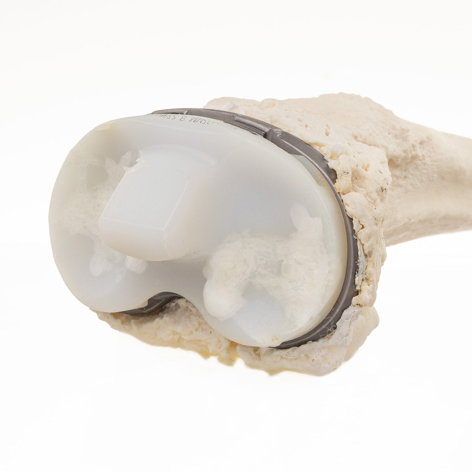 Premium Human Tibia Bone for Medical Research & Education - Ideal for Anatomy Studies, Surgical Training & Forensic Science