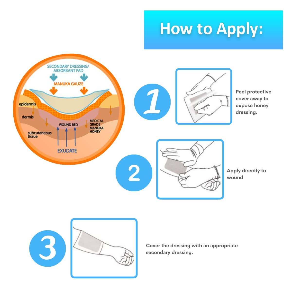 Manuka Honey Gauze Dressing - Medical Grade Wound Care Patches (10 Pack) for First Aid & Burns