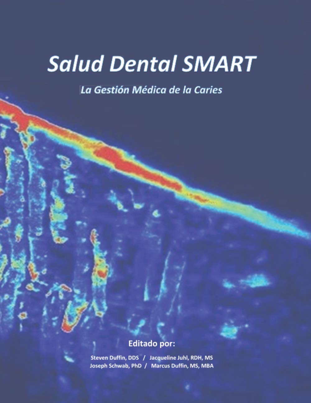 Dental Health SMART: Medical Management of Cavities - English Edition | Prevent & Treat Tooth Decay for Better Oral Care