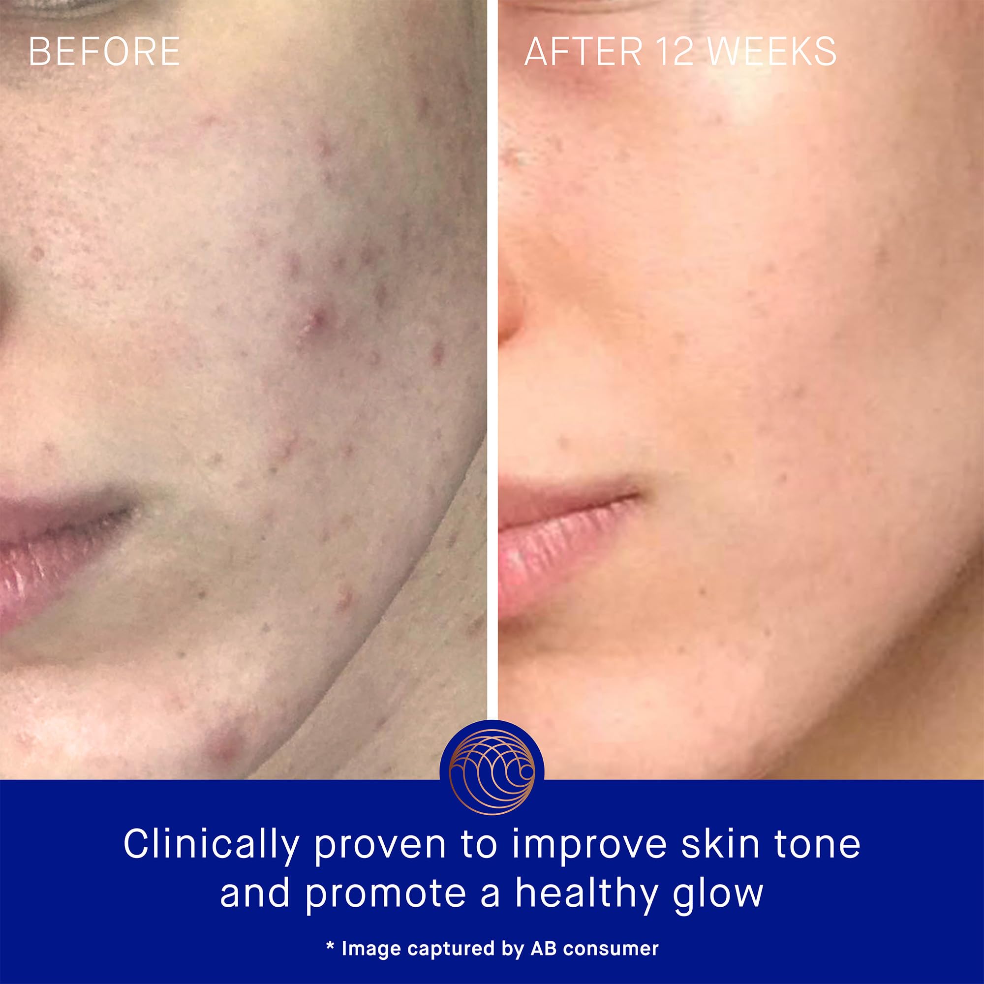 Best Face Cream for Dry Skin - Hydrating & Nourishing Moisturizer with Natural Ingredients | Perfect for Daily Skincare Routine & Nighttime Use