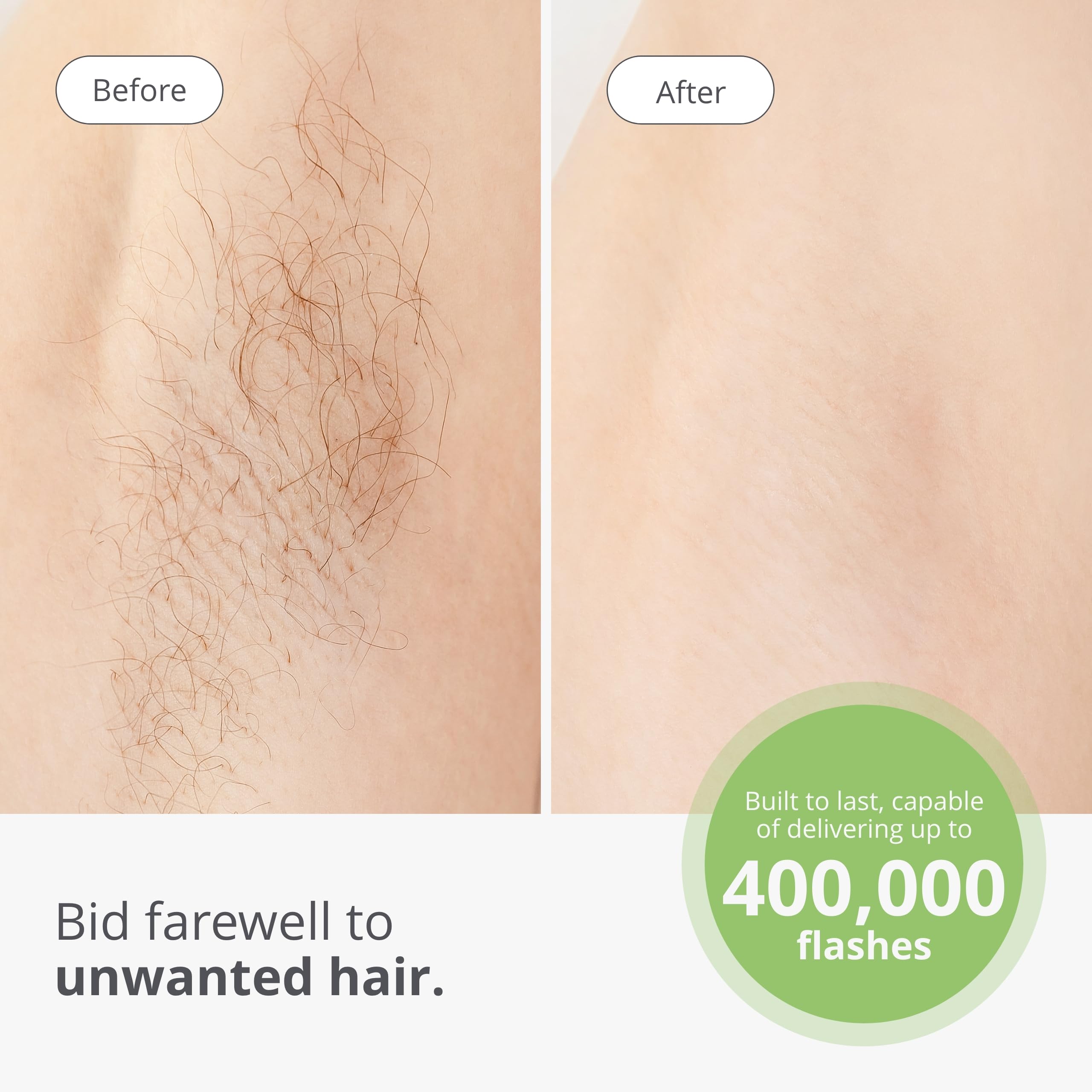 Tria Beauty Hair Removal Device IPL - Permanent At-Home Hair Removal System - Safe & Effective Alternative to Laser Hair Removal - IPL Device for Face & Body - Smooth Skin for Summer, Beach & Special Occasions