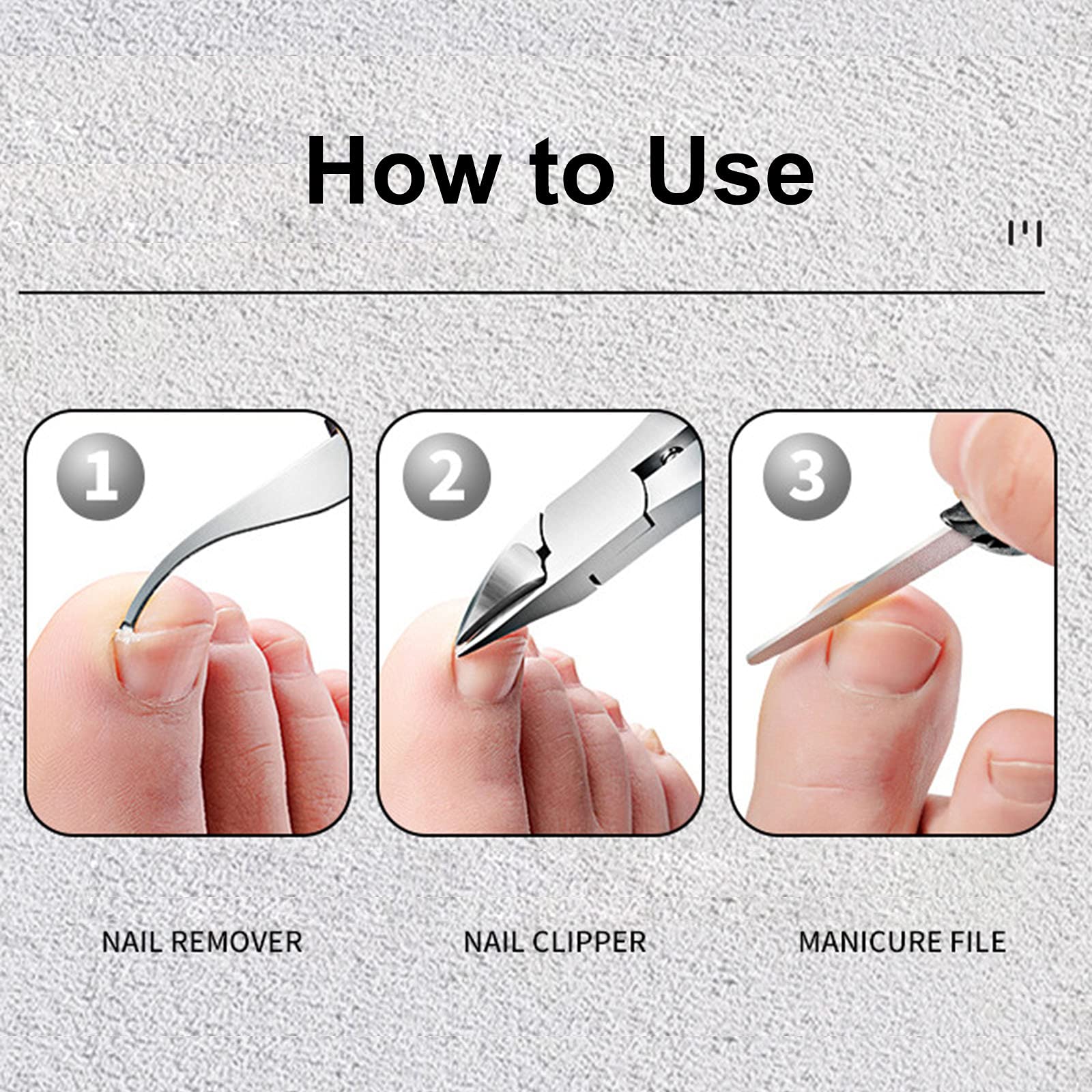 Ubersweet® Professional Ingrown Toenail Clippers Set - Foldable Multi-Functional Toenail Trimmer, Cleaner & Nail File Kit for Pain Relief & Foot Care - Perfect for Home, Travel & Pedicure Use