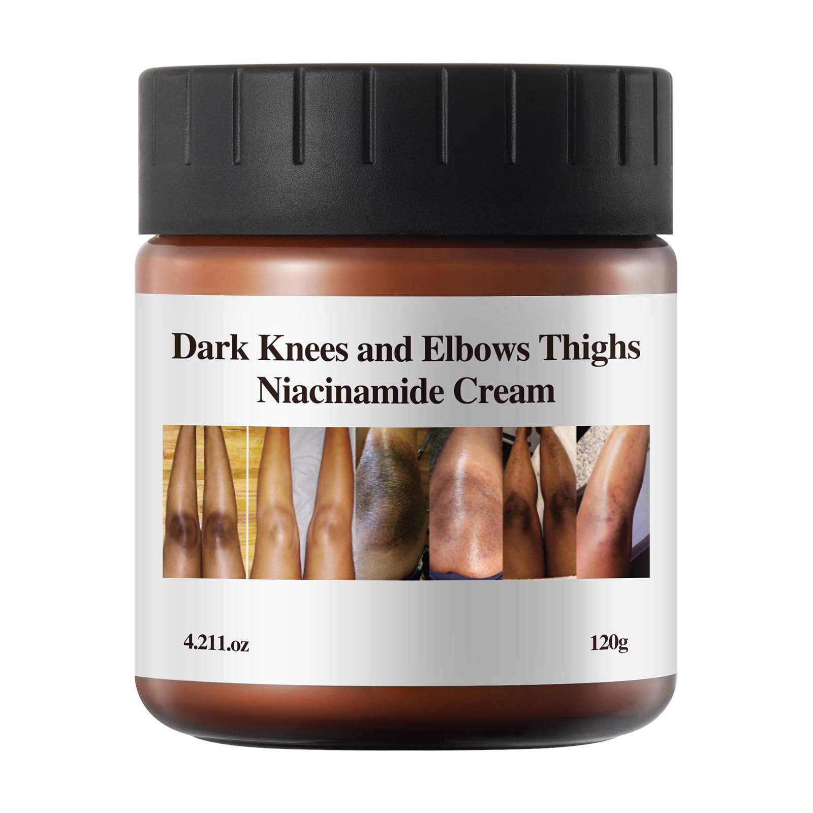 Strong Yellow Peeling Oil for Dark Skin - Extra Strength Chemical Exfoliant for Body, Hands & Feet - Dark Knuckle, Underarm & Toe Brightening Cream - Perfect for At-Home Spa Treatments & Skin Renewal