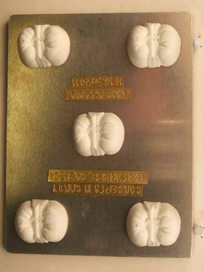 Kidney-Shaped Chocolate Candy Mold for Renal, Urinary & Endocrine System - Perfect for Medical Education, Nursing School Gifts & Science-Themed Desserts