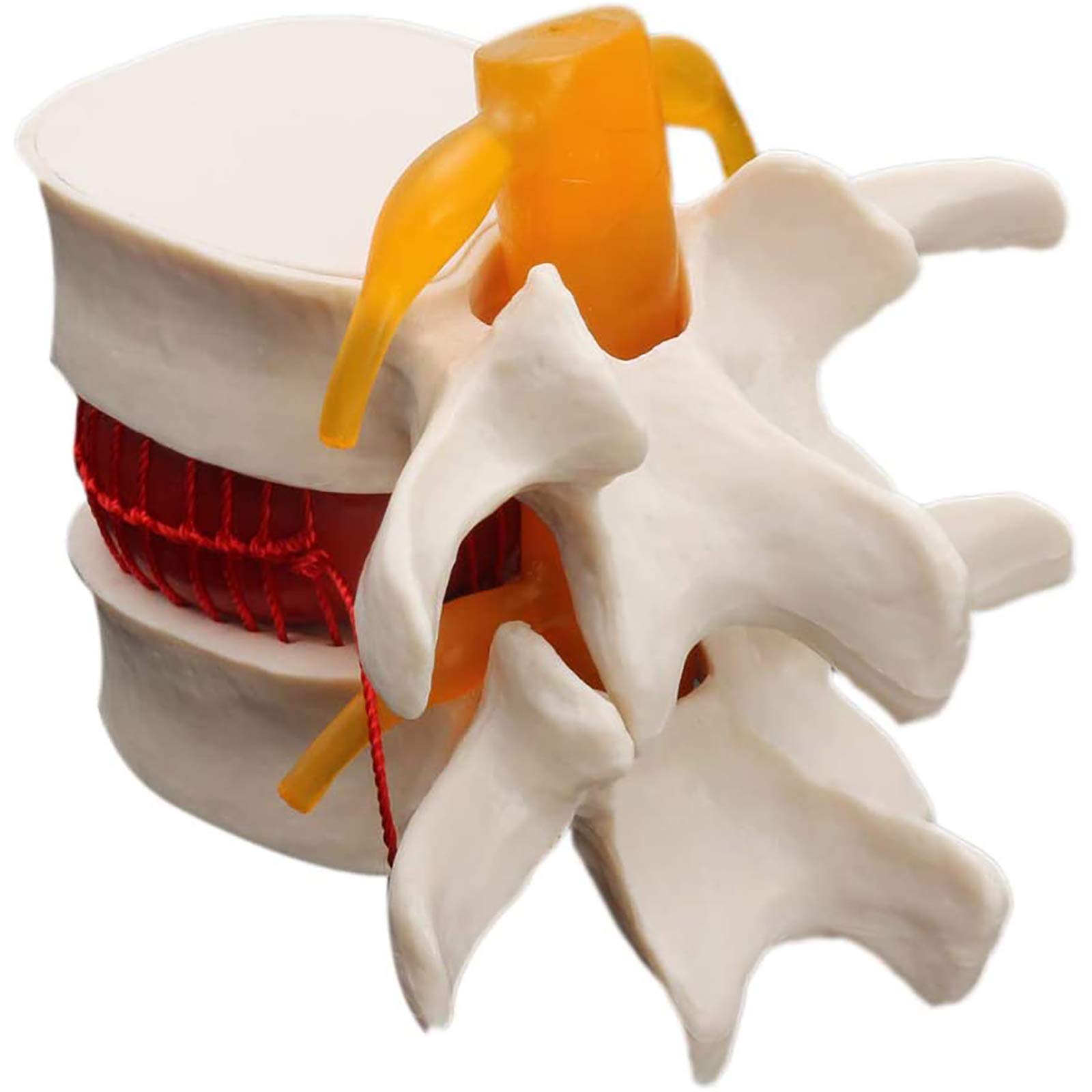 Human Anatomy Spine Model - Lumbar Disc Herniation Demonstration with Skull & Brain - Medical Teaching Tool for Schools, Chiropractors & Physical Therapy - Perfect for Classroom, Clinic & Patient Education