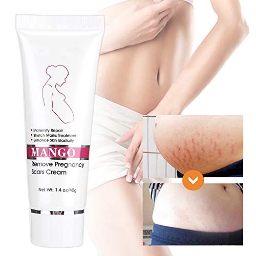 Best Stretch Mark & Scar Removal Cream for Pregnancy - Maternity Skin Repair Treatment for Smooth & Hydrated Skin | Postpartum Care & Daily Moisturizing