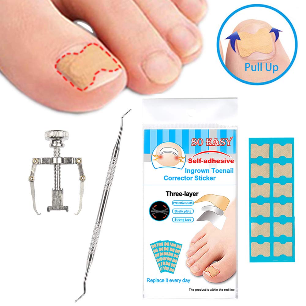 EXCLUZO Nail Correction Kit - Toenail & Fingernail Straightening Treatment with Stickers, Clamp & Lifter - Fix Ingrown, Curved Nails for Healthy Feet & Hands - Perfect for Pedicures, Manicures & Daily Nail Care