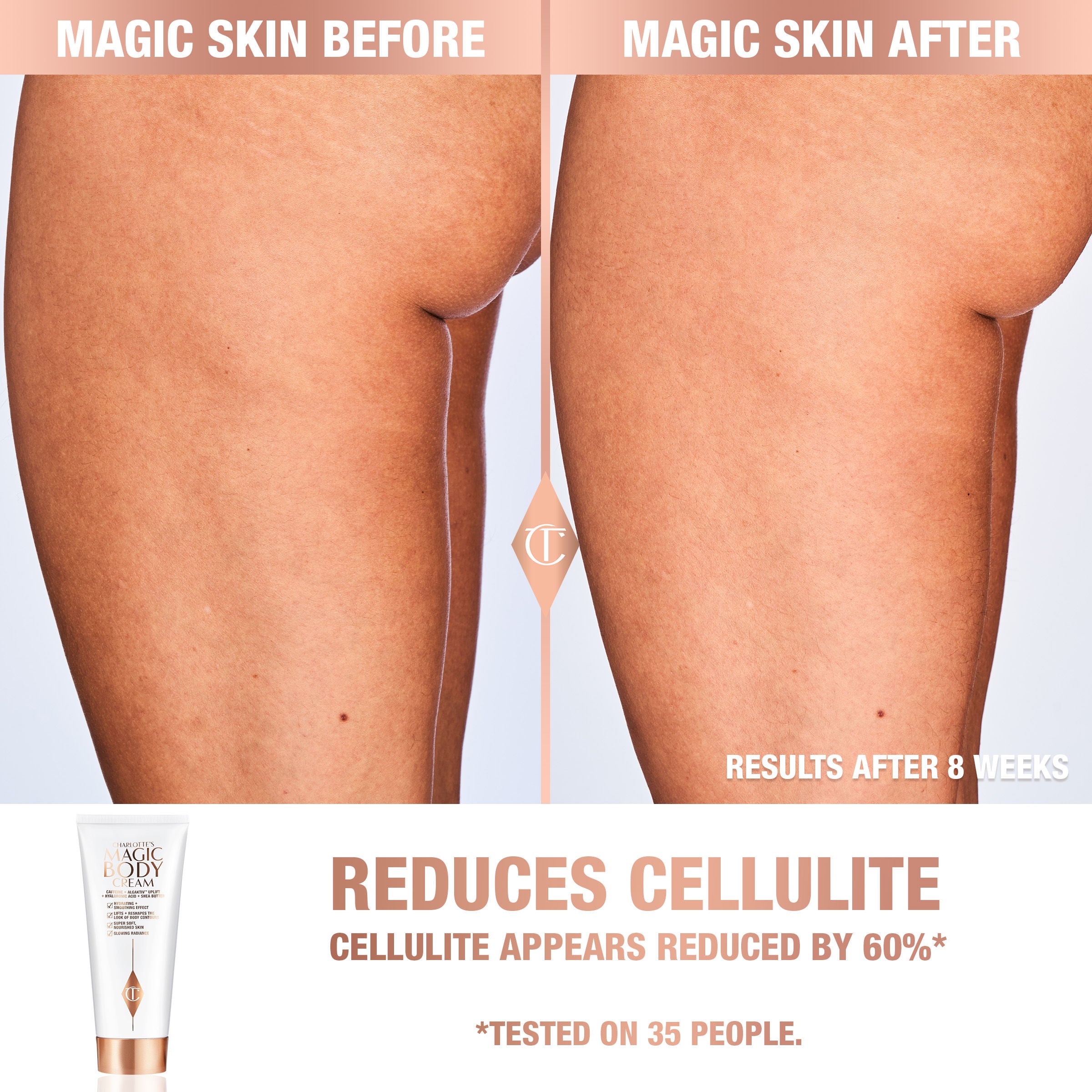 Charlotte's Magic Body Cream - Hydrating & Firming Moisturizer for Dry Skin | Anti-Aging & Stretch Mark Reduction | Perfect for Daily Skincare & Post-Pregnancy Care
