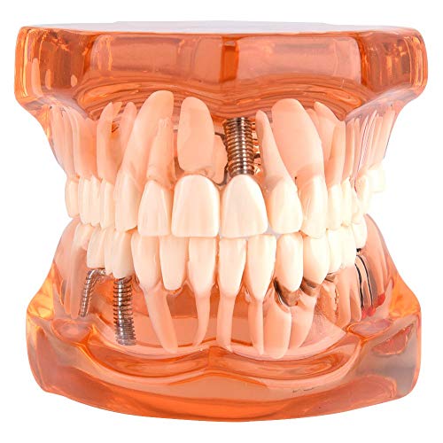 Professional Dental Teeth Model - Removable Demonstration Denture for Dental Teaching & Study | Standard Teaching Aid for Kids & Students | Perfect for Classroom Education, Dental Practice & Home Learning