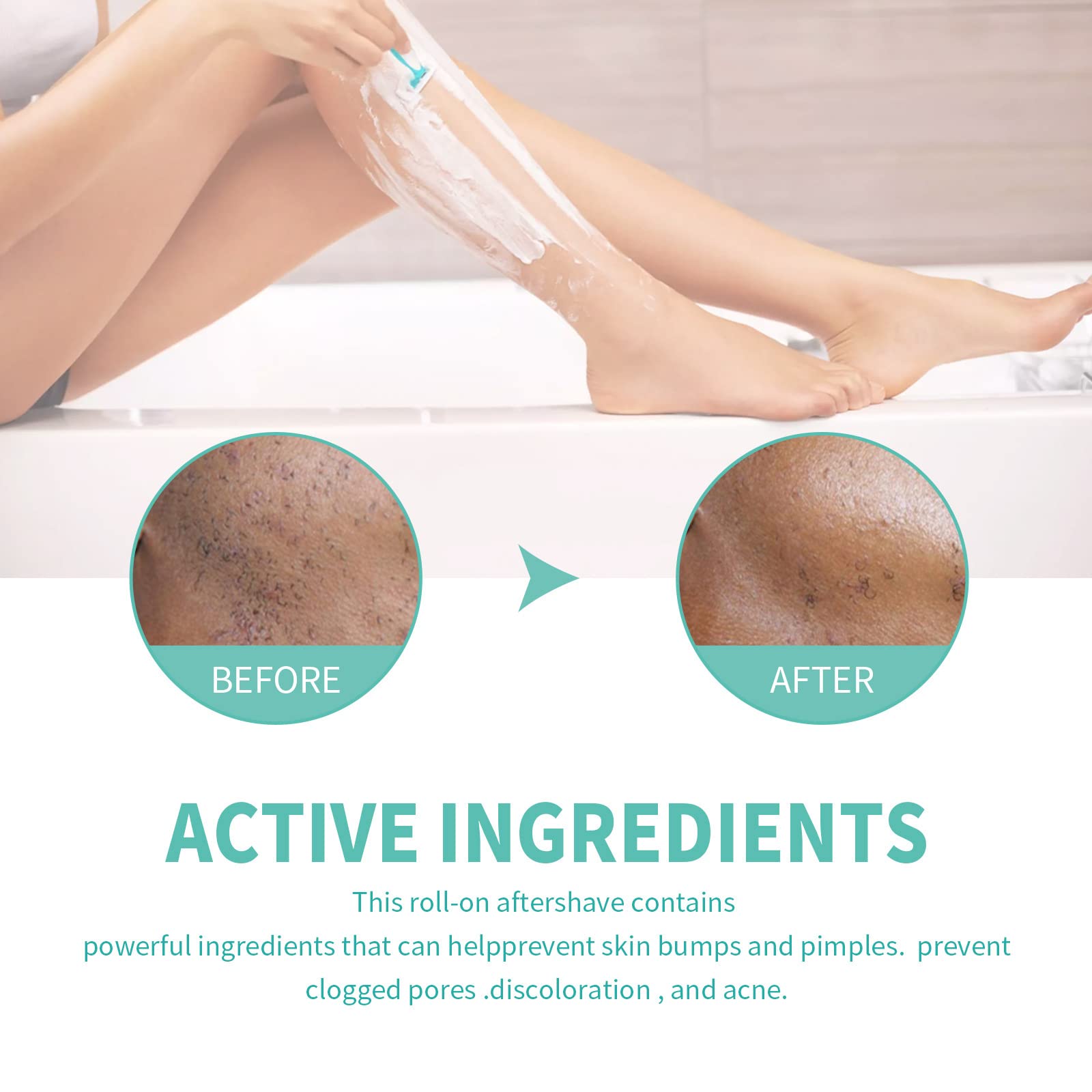 Best Razor Bumps Treatment Solution for Men & Women | Ingrown Hair Prevention | Redness & Itch Relief | Moisturizing Repair Essence | Post-Shave Care for Smooth Skin