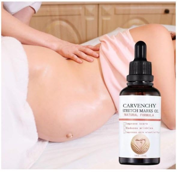 Ramley Stretch Marks Oil for Women - 30ML | Pregnancy Safe, Deep Moisturizing & Skin Repair for Radiant Look | Perfect for Pre & Postpartum Care, Daily Hydration & Stretch Mark Prevention