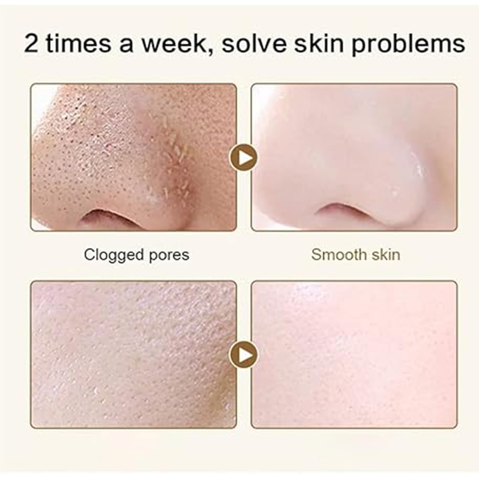 Carrot Compound Acid Foam Mask - Deep Pore Cleansing Bubble Face Mask for Blackhead Removal & Brightening (3 Pack) | Perfect for Acne-Prone Skin & Weekly Detox Routine