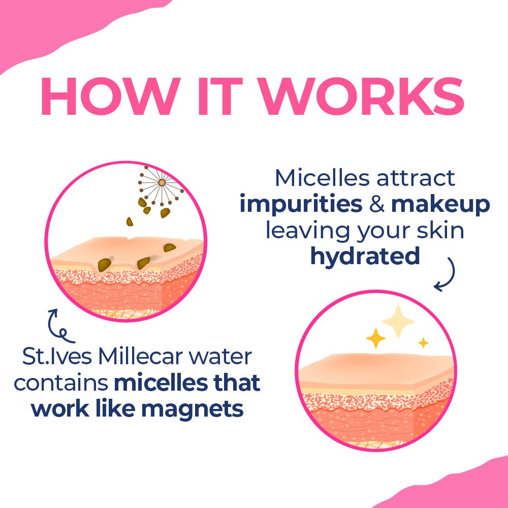 St. Ives Rosy Glow Rose Micellar Water - 100% Natural Extracts, 3-in-1 Cleanser, Toner & Makeup Remover for All Skin Types | Gentle, Paraben-Free, Alcohol-Free & Oil-Free Face Cleansing Water (400ml) | Perfect for Daily Skincare, Makeup Removal & Hydration Routine