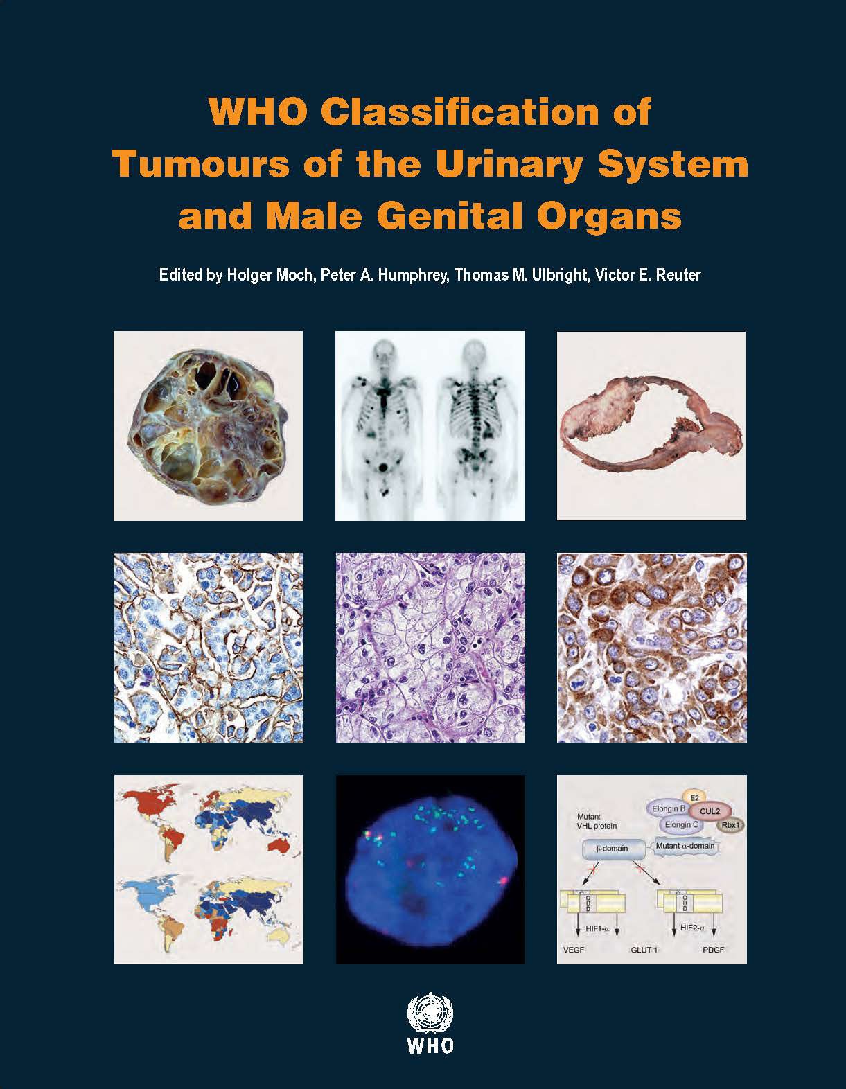 WHO Classification of Tumours of the Urinary System and Male Genital Organs - Comprehensive Medical Reference Book for Urologists, Pathologists & Oncologists | Essential for Cancer Diagnosis, Research & Clinical Practice
