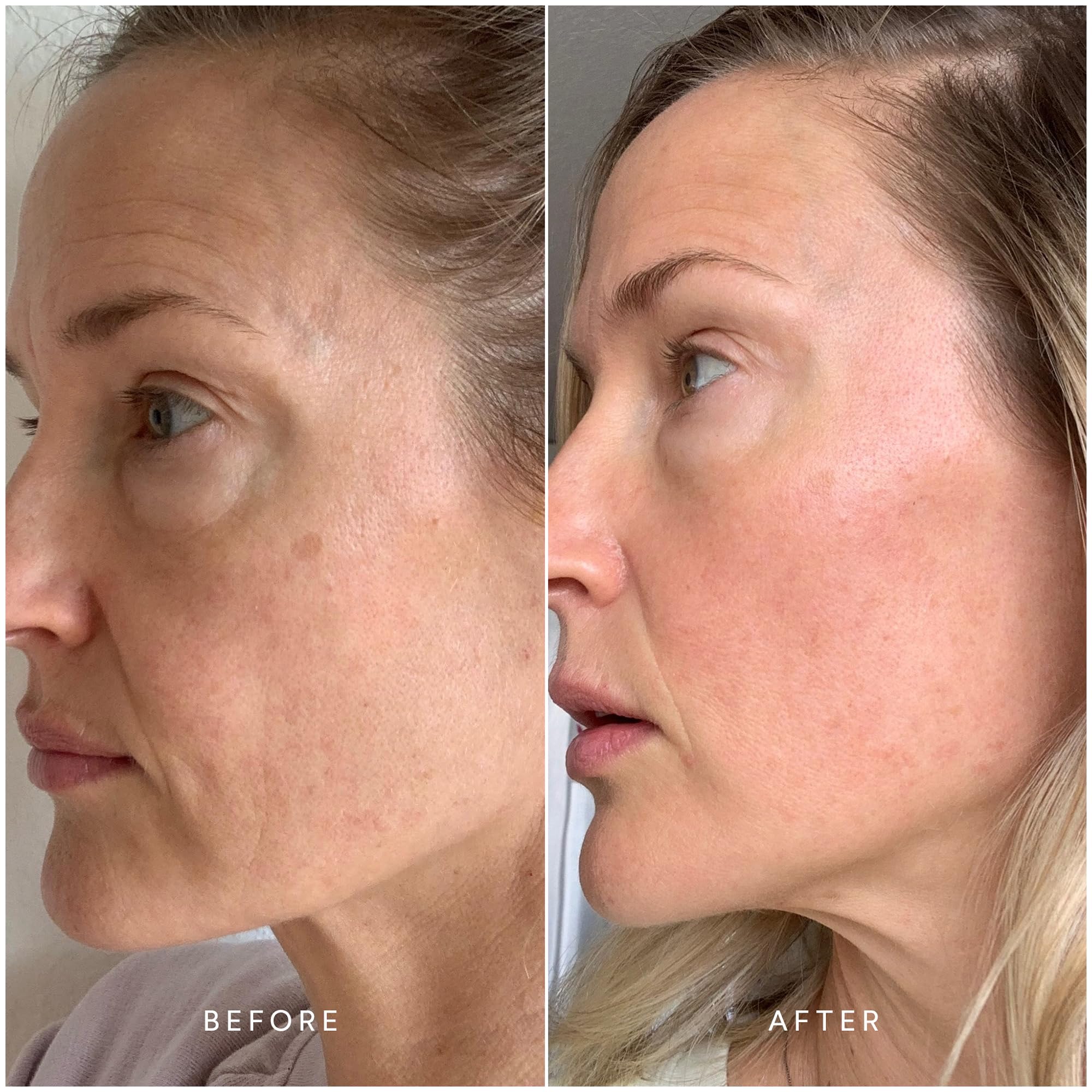 **True Botanicals Collagen Boosting Essentials Set – Hydrating Skincare for Fine Lines & Wrinkles | Ginger Turmeric Cleansing Balm, Chebula Active Serum & Eye Patches | Anti-Aging Routine for Glowing Skin**    *(Note: If the original title was in Chinese, here’s the English version optimized for SEO with added use case.)*