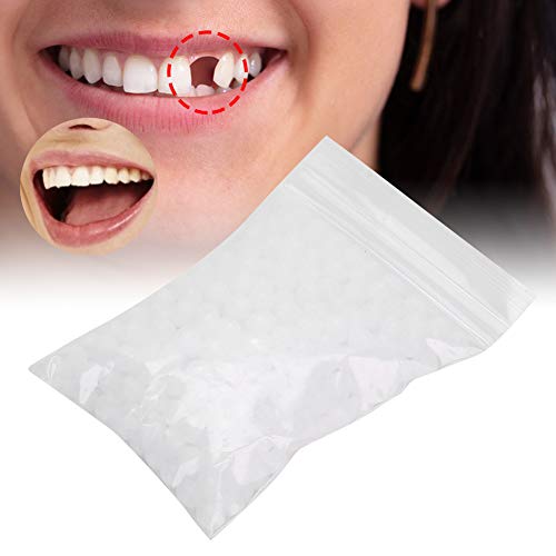 **Temporary Tooth Repair Kit - Moldable Thermal Fitting Beads for Broken Teeth, DIY Dental Filling Material, Snap-On Instant Smile Solution (20g) - Perfect for Travel, Emergency Dental Care & Confidence Boost**