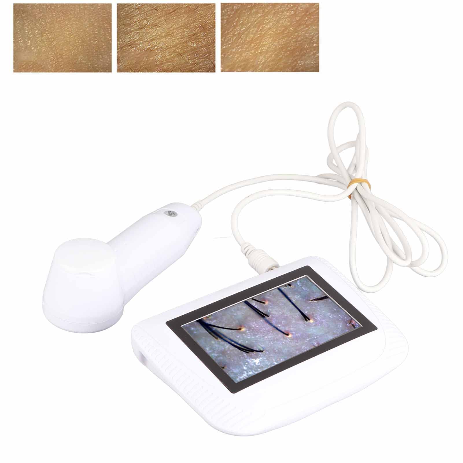 5 Inch LCD Digital Skin & Hair Analyzer Machine - HD Skin Pigment Tester & Hair Follicle Detector with Skin Diagnosis | Perfect for Dermatologists, Salons & Home Skin Care (US)