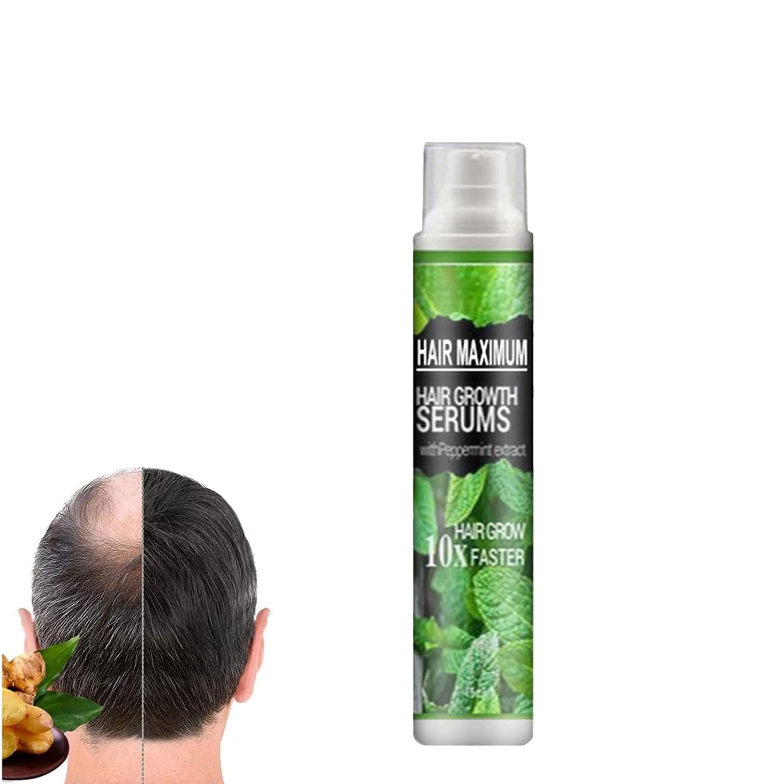 Herbalrevive Natural Hair Growth Essence Spray - Prevent Postpartum Hair Loss & Stimulate Follicles for Men & Women | 1PC | Perfect for Thinning Hair, Daily Scalp Care & Hair Regrowth Treatment