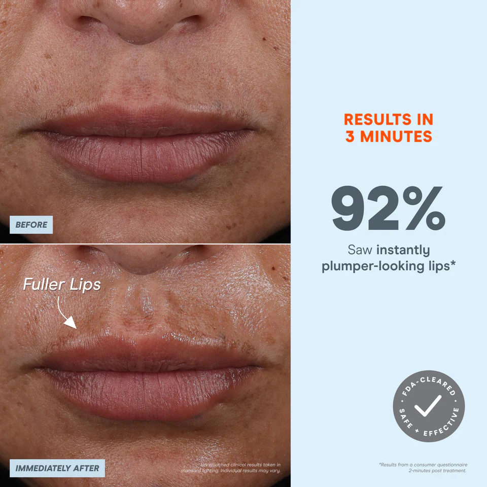 NuFACE FIX MicroWand - Anti-Aging Facial Toning Device for Wrinkles & Fine Lines | Portable Skincare Tool for Home & Travel Use