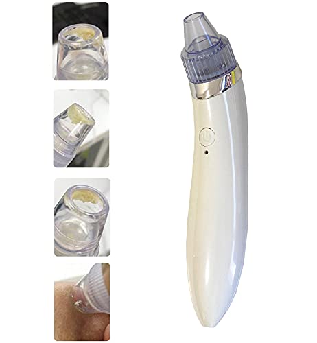 USB Rechargeable Blackhead Remover & Pore Cleaner - 3 Speed Facial Suction Tool for Deep Cleansing - Perfect for Acne Prone Skin & Blackhead Removal at Home