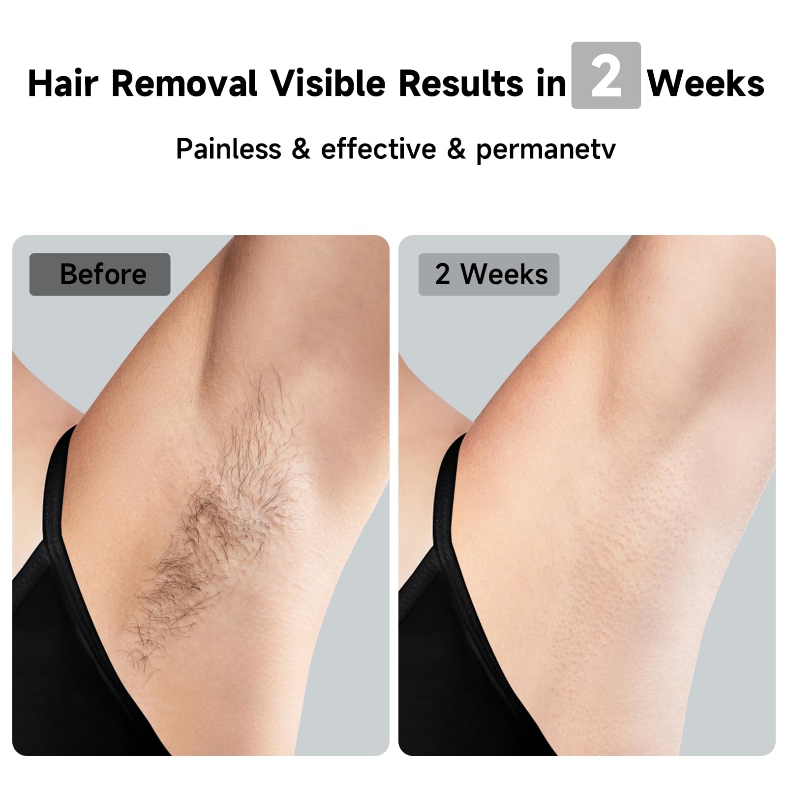 JOVS Laser Hair Removal Device for Women & Men - Painless 37°F Ice Cooling Technology, 3-in-1 Hair Removal & Skin Rejuvenation, 8 Modes for Full Body Care, Touch Screen - White | At-Home IPL Treatment for Face, Legs, Bikini Line & Underarms