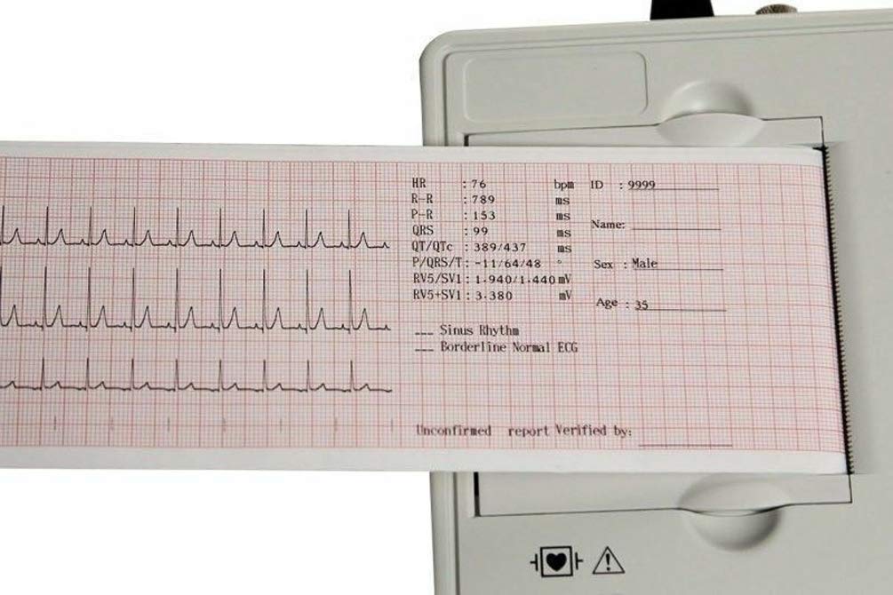 20 Pack Thermal Printer Paper Rolls for ECG EKG Electrocardiograph - 80mm x 20m, 3 Channel - Perfect for Medical Clinics, Hospitals & Home Health Monitoring