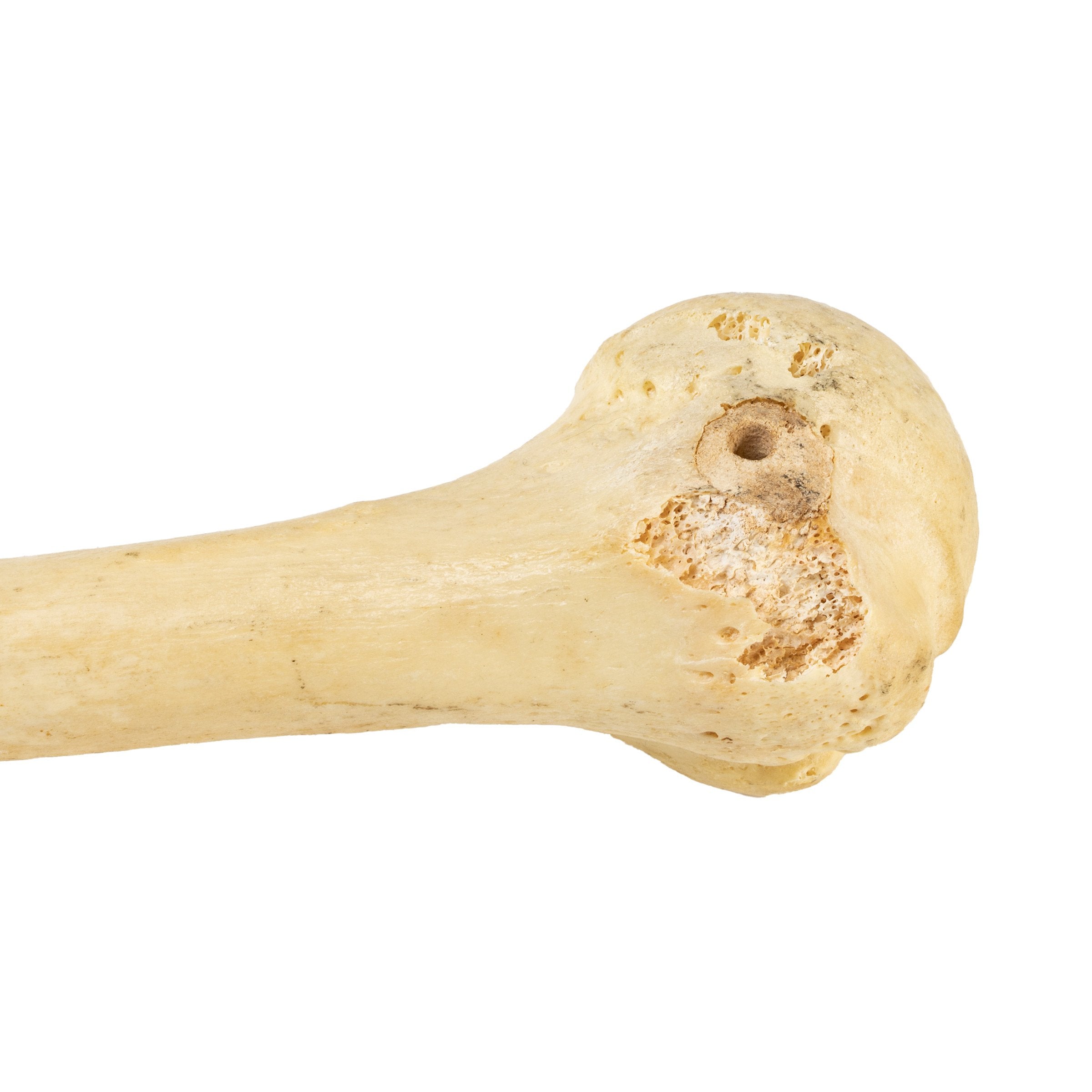 Authentic Human Humerus, Radius & Ulna Bones - Medical Study, Anatomy Education & Science Classroom Specimen