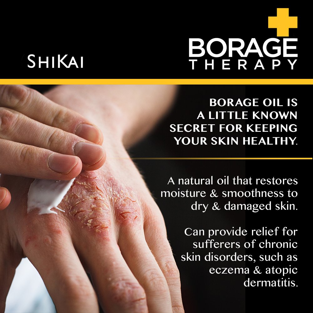 ShiKai Borage Therapy Body Lotion 8oz - Fragrance Free Moisturizing Cream for Dry Skin, Hands & Body with Borage Seed Oil - Perfect for Daily Hydration & Sensitive Skin Care