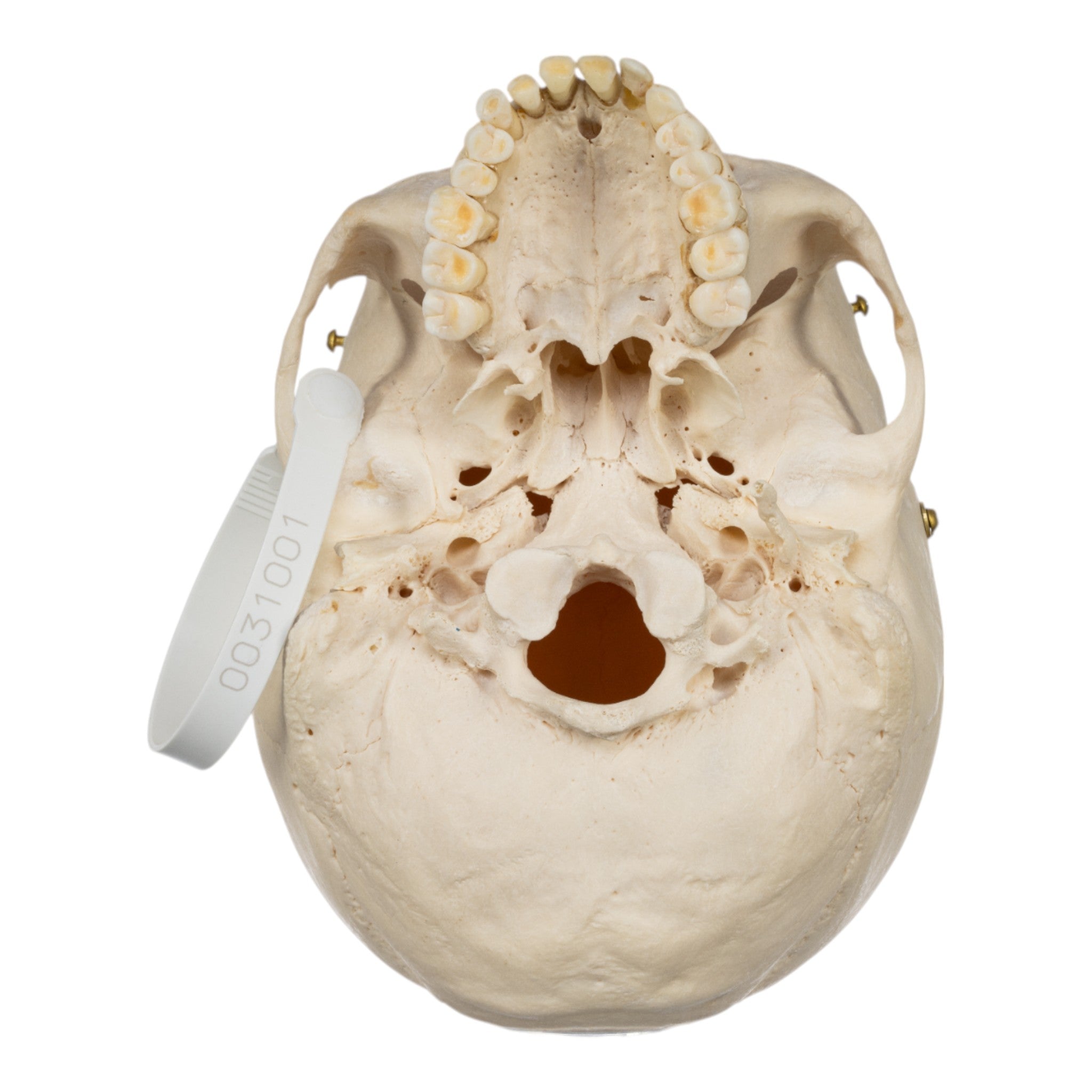 Real Human Half Skeleton Disarticulated - Anatomical Model for Medical Students, Science Classrooms & Halloween Decor