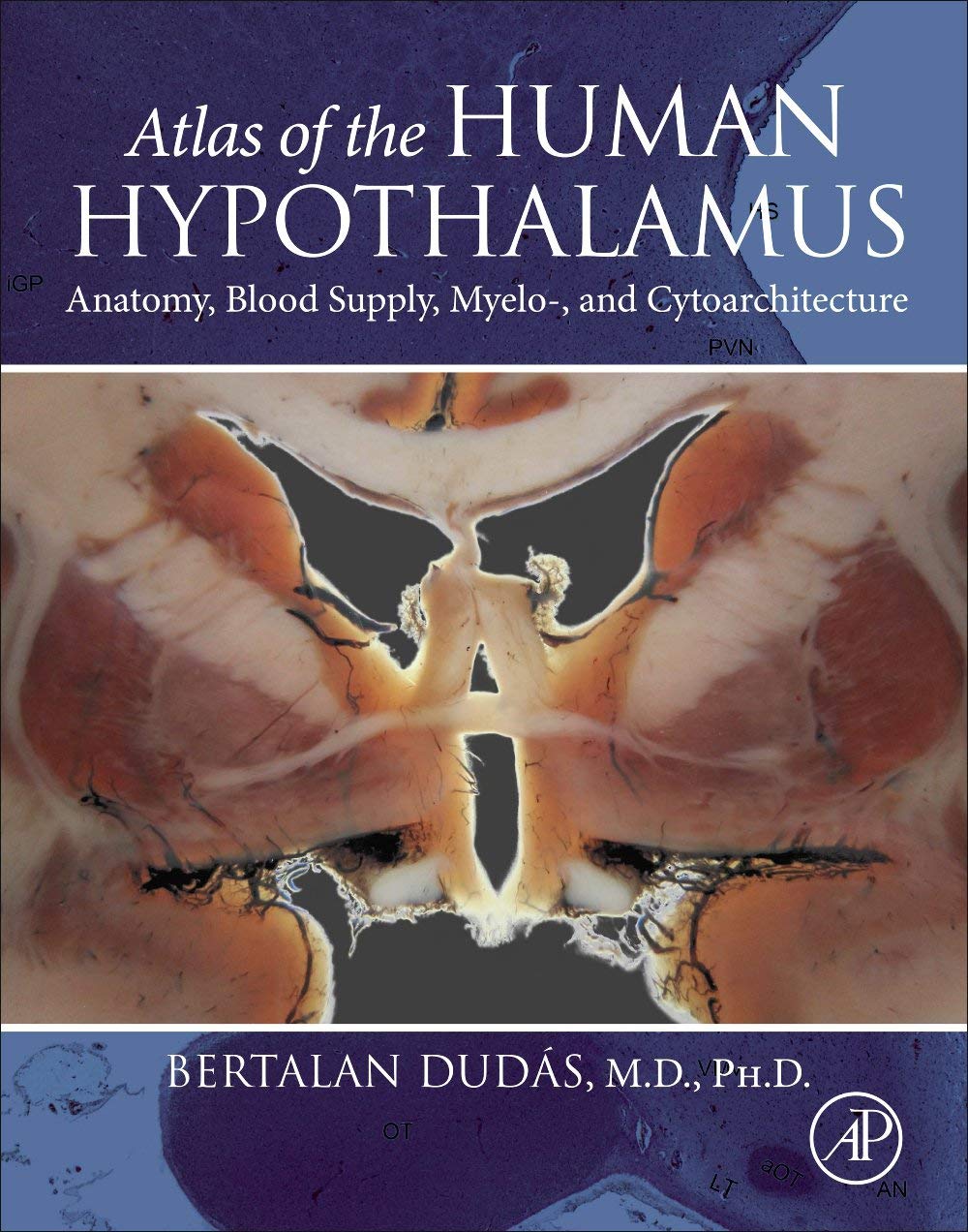 Atlas of the Human Hypothalamus - Comprehensive Brain Anatomy Reference Guide for Medical Students & Neuroscience Research | Perfect for Neurology Studies & Healthcare Professionals
