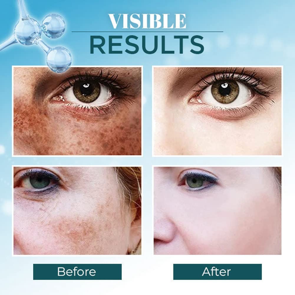 Dark Spot Corrector for Face & Body - Natural Pigmentation Treatment with Cruelty-Free Ingredients | Brightening Serum for Women (30g) | Perfect for Daily Skincare Routine & Hyperpigmentation Care